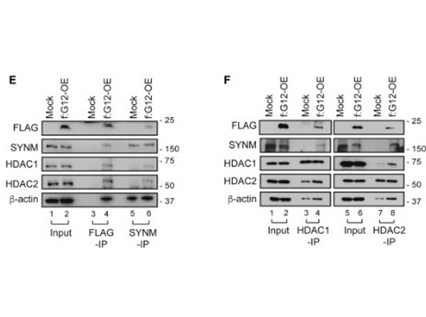 Immunoprecipitation using TrueBlot Anti-Mouse IgG Immunoprecipitation using TrueBlot Anti-Mouse IgG