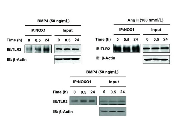 Immunoprecipitation using TrueBlot Anti-Goat Immunoprecipitation using TrueBlot Anti-Goat