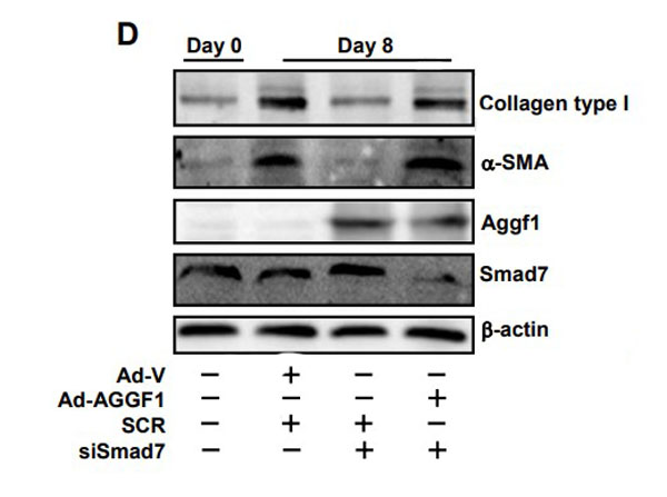 Western Blot results using Bovine Collagen Type I Western Blot results using Bovine Collagen Type I