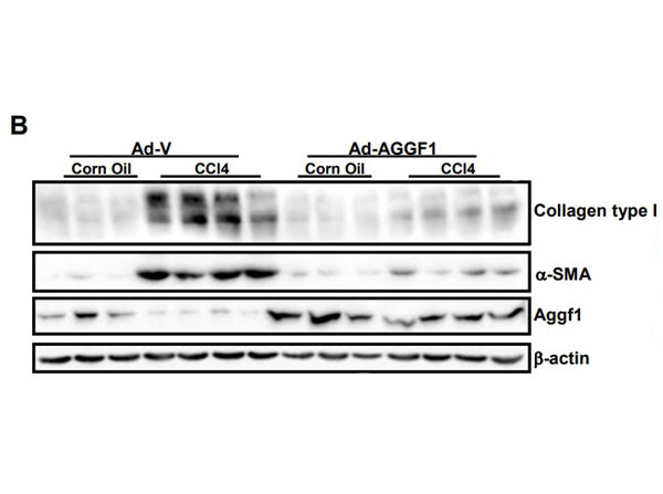 Western Blot results using Bovine Collagen Type I Western Blot results using Bovine Collagen Type I