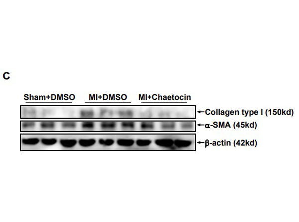 Western Blot results using Bovine Collagen Type I Western Blot results using Bovine Collagen Type I