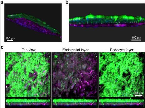 Immunofluorescent using Human albumin Texas Red Immunofluorescent using Human albumin Texas Red