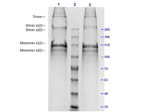 SDS-PAGE Results of Human Collagen Type I SDS-PAGE Results of Human Collagen Type I