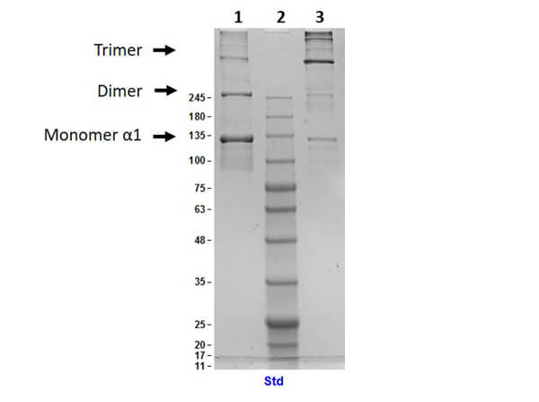 SDS-PAGE Results of Human Collagen Type III SDS-PAGE Results of Human Collagen Type III