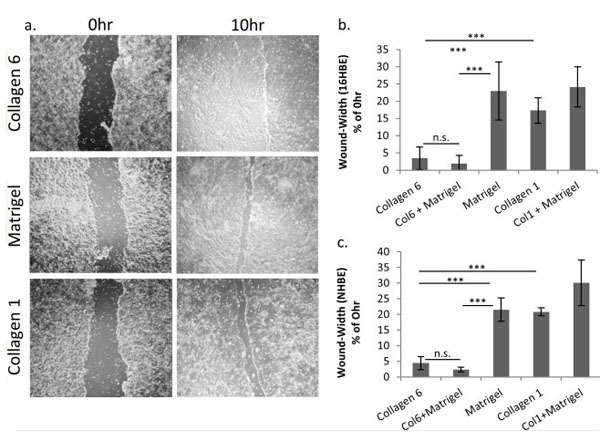 2D culture using Human Collagen Type VI 2D culture using Human Collagen Type VI