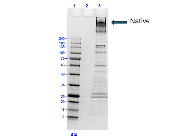 SDS-PAGE of Collagen VI SDS-PAGE of Collagen VI