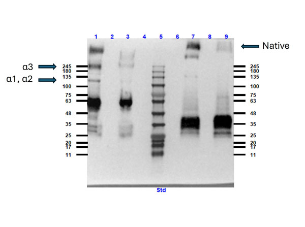 Western Blot of Collagen VI Western Blot of Collagen VI