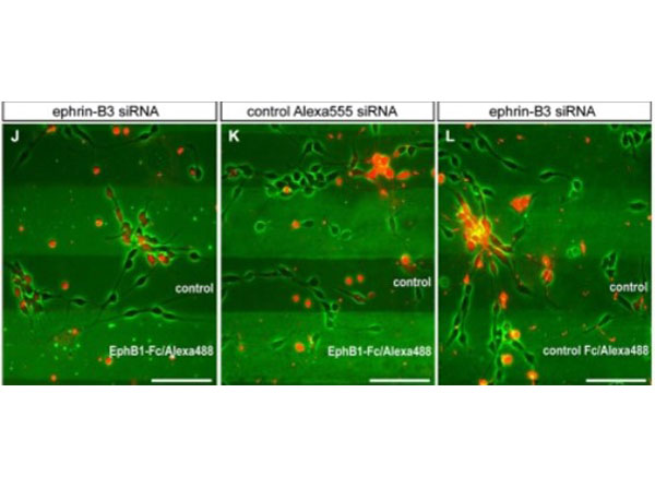 Stripe Assay using Human IgG Fc Stripe Assay using Human IgG Fc