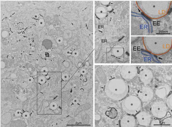 Electron Microscopy using Human Transferrin HRP Electron Microscopy using Human Transferrin HRP