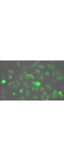 Rockland Lactate Dehydrogenase Antibody-Immunofluorescence Rockland Lactate Dehydrogenase Antibody-Immunofluorescence