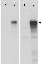 Anti-Gli-1 Antibody - Western Blot Anti-Gli-1 Antibody - Western Blot