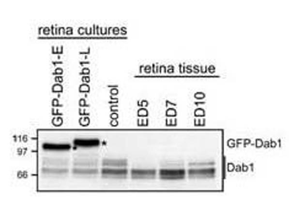 WB - Dab1 Antibody WB - Dab1 Antibody