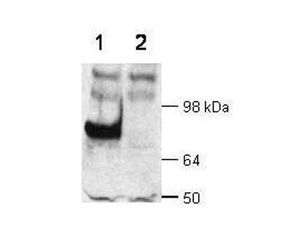 WB - Dab1 Antibody WB - Dab1 Antibody