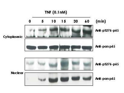 Western Blot - Anti-NFKB p65 (Rel A) pS276 Antibody Western Blot - Anti-NFKB p65 (Rel A) pS276 Antibody