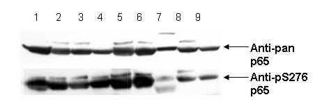 Western Blot - Anti-NFKB p65 (Rel A) pS276 Antibody Western Blot - Anti-NFKB p65 (Rel A) pS276 Antibody