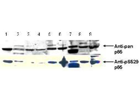 Western Blot of Anti-NFKB p65 (Rel A) pS529 Antibody Western Blot of Anti-NFKB p65 (Rel A) pS529 Antibody