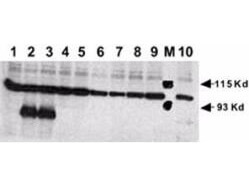 Anti-Human NOTCH 1 (Cleaved N Terminal) Antibody - Western Blot Anti-Human NOTCH 1 (Cleaved N Terminal) Antibody - Western Blot
