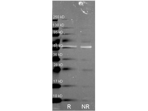 Anti Catalase Polyclonal Antibody-Western blot Anti Catalase Polyclonal Antibody-Western blot