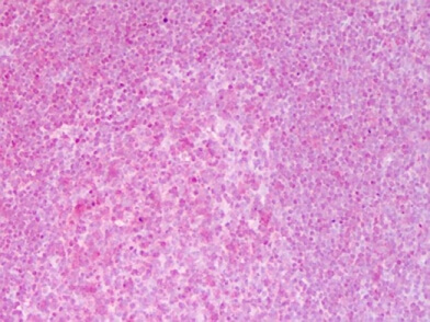 NFkB p65 (Rel A) antibody – IHC