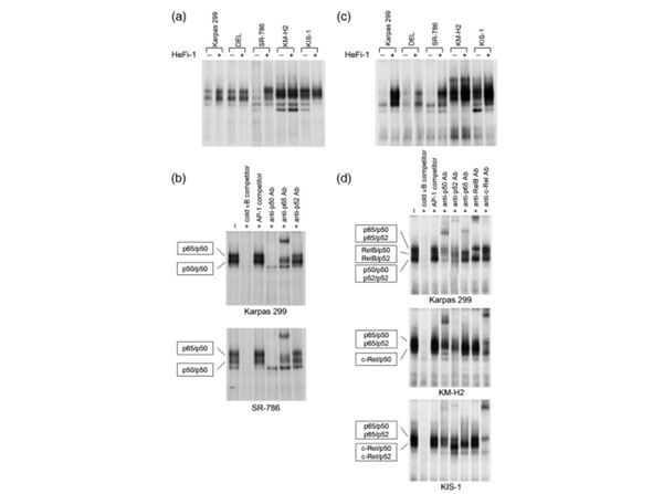 EMSA results using Anti-NFKB p52 EMSA results using Anti-NFKB p52