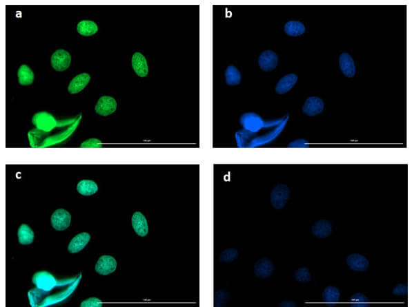 Immunofluorescence microscopy using Fluorescent TrueBlot® anti-rabbit IgG Immunofluorescence microscopy using Fluorescent TrueBlot® anti-rabbit IgG