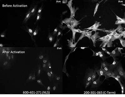 Anti-NFKB p65 (Rel A) Antibody – Immunocytochemistry Anti-NFKB p65 (Rel A) Antibody – Immunocytochemistry