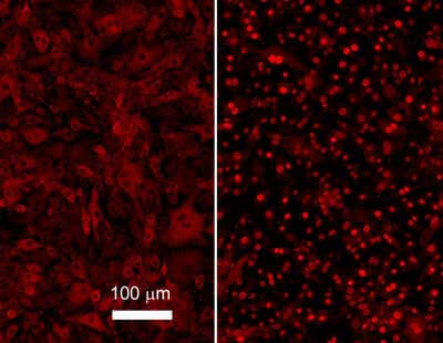 Anti-NFKB p65 (Rel A) Antibody - Immunofluorescence Microscopy Anti-NFKB p65 (Rel A) Antibody - Immunofluorescence Microscopy