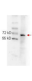 Anti-NFKB p65 (Rel A) Antibody - Western Blot Anti-NFKB p65 (Rel A) Antibody - Western Blot