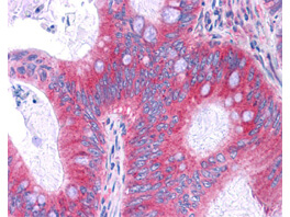 Anti-NFKB p65 (Rel A) Antibody – Immunohistochemistry Anti-NFKB p65 (Rel A) Antibody – Immunohistochemistry