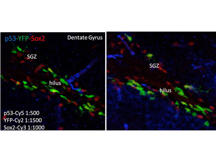 Immunofluorescence - Mouse anti-p53 Immunofluorescence - Mouse anti-p53
