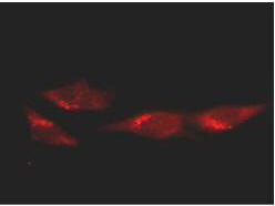 p53 Antibody - Immunofluorescence Microscopy p53 Antibody - Immunofluorescence Microscopy