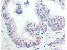 AKT pS473 Monoclonal Antibody – Immunohistochemistry