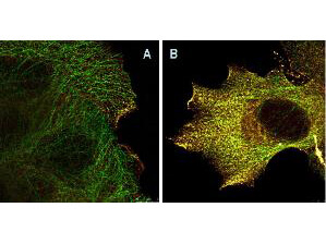 AKTpS473 Antibody - STED Nanoscopy