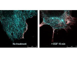 Anti-AKT pS473 Antibody - Confocal Microscopy