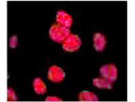 ATM phospho S1981 Antibody