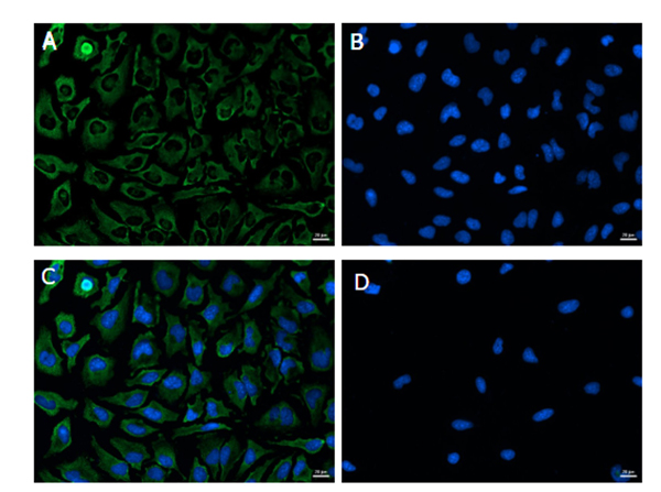 Immunofluorescence of GAPDH Immunofluorescence of GAPDH