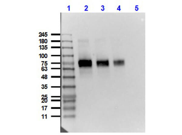Western Blot of Mouse Anti-Mesothelin Antibody Western Blot of Mouse Anti-Mesothelin Antibody