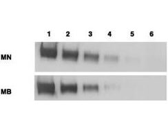 Anti-Mesothelin Antibodies - Western Blot Anti-Mesothelin Antibodies - Western Blot