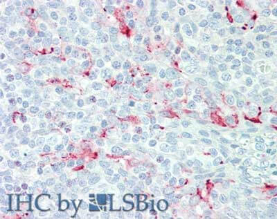 Immunohistochemistry of Mouse anti-Mesothelin antibody Immunohistochemistry of Mouse anti-Mesothelin antibody