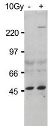 Anti-ATM Monoclonal Antibody - Western Blot Anti-ATM Monoclonal Antibody - Western Blot