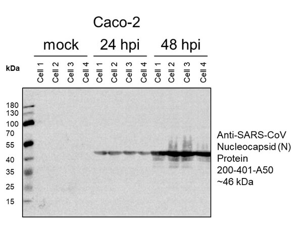 Western Blot of Rabbit Anti-SARS-CoV (N) Antibody Western Blot of Rabbit Anti-SARS-CoV (N) Antibody
