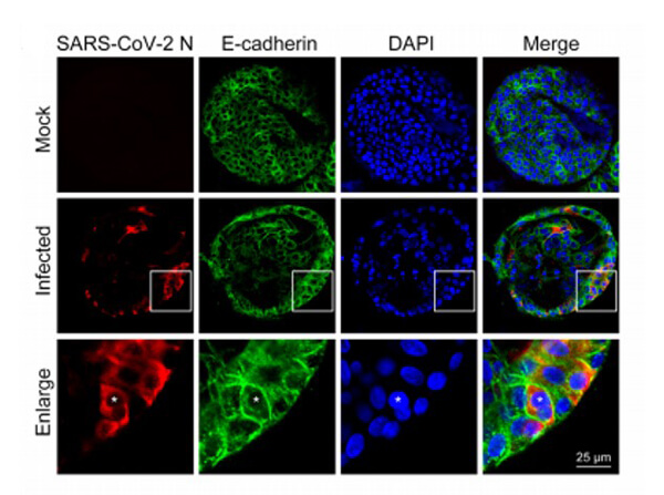 Sars Nucleocapsid Protein Antibody