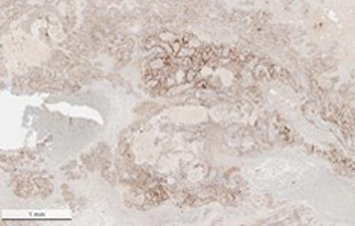 Immunohistochemistry of Anti-SARS-CoV Nucleocapsid (N) Antibody Immunohistochemistry of Anti-SARS-CoV Nucleocapsid (N) Antibody