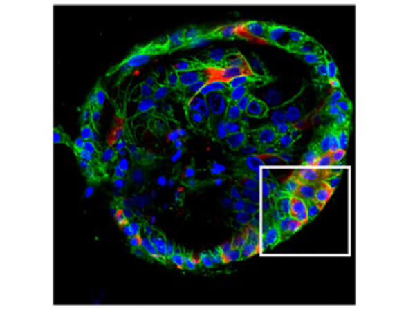 Immunofluorescence of Rabbit Anti-SARS-CoV Nucleocapsid (N) Antibody Immunofluorescence of Rabbit Anti-SARS-CoV Nucleocapsid (N) Antibody