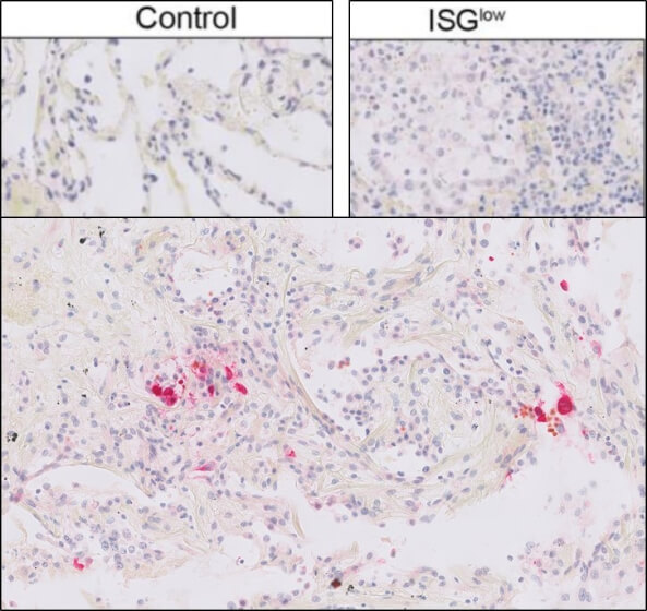 Immunohistochemistry of Rabbit Anti-SARs CoV Nucleocapsid Antibody Immunohistochemistry of Rabbit Anti-SARs CoV Nucleocapsid Antibody