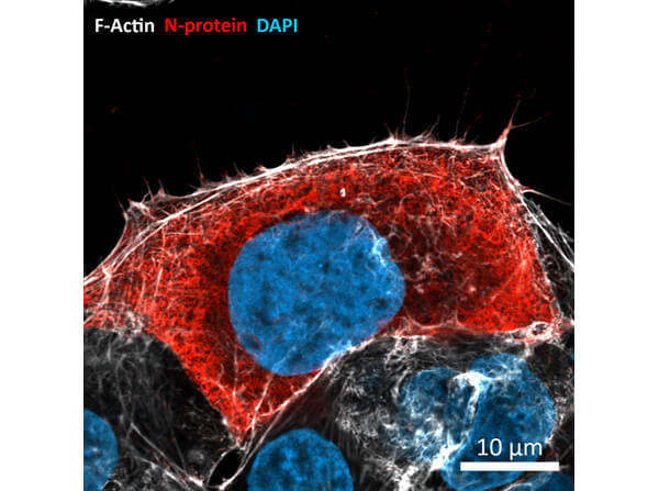 Immunofluorescence of Rabbit Anti-SARS CoV (N) Protein Antibody Immunofluorescence of Rabbit Anti-SARS CoV (N) Protein Antibody