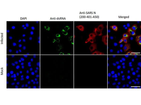 Immunofluorescence assay using Rabbit Anti-SARS-CoV Nucleocapsid (N) Antibody Immunofluorescence assay using Rabbit Anti-SARS-CoV Nucleocapsid (N) Antibody