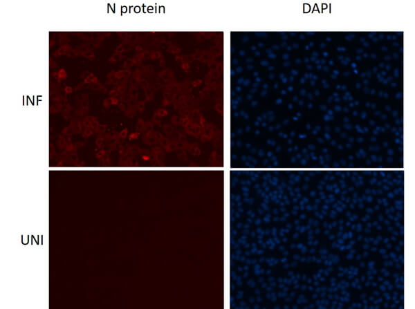 Immunofluorescence assay using Rabbit Anti-SARS-CoV Nucleocapsid (N) Antibody Immunofluorescence assay using Rabbit Anti-SARS-CoV Nucleocapsid (N) Antibody