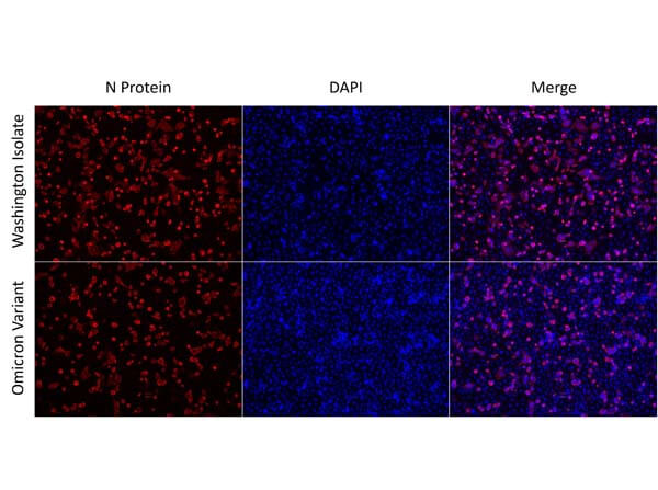 Immunofluorescence of Anti-SARS CoV Nucleocapsid Immunofluorescence of Anti-SARS CoV Nucleocapsid