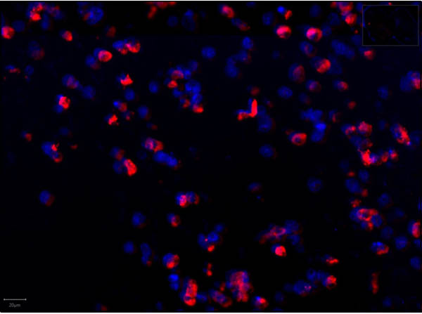 Immunofluorescence of Anti-SARS CoV Nucleocapsid Immunofluorescence of Anti-SARS CoV Nucleocapsid